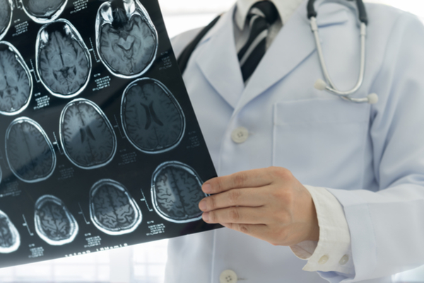 cefalea visita neurologica