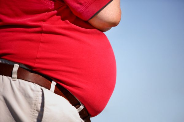 obesità rischio aterosclerosi