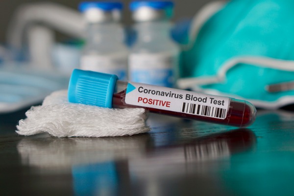 Provetta Test Coronavirus