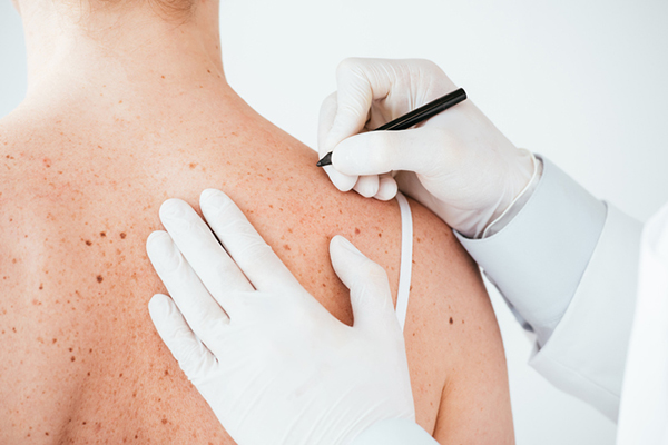 Visita dermatologica