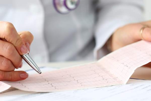 tracciato dell'elettrocardiogramma
